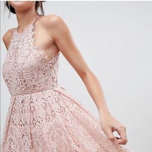ASOS Scallop Lace Dress